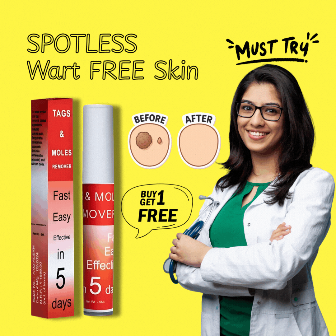 Tags & Moles Remover (Buy 1 Get 1 Free🔥🔥)