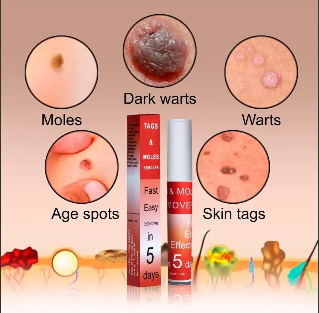 Tags & Moles Remover (Buy 1 Get 1 Free🔥🔥)